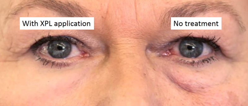 Illustration for article titled MIT's Invisible Second Skin Cream Makes Wrinkles Disappear